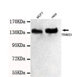 Anti-TRIM33 (C-terminus) Antibody from Bioworld Technology (MB0067) - Antibodies.com