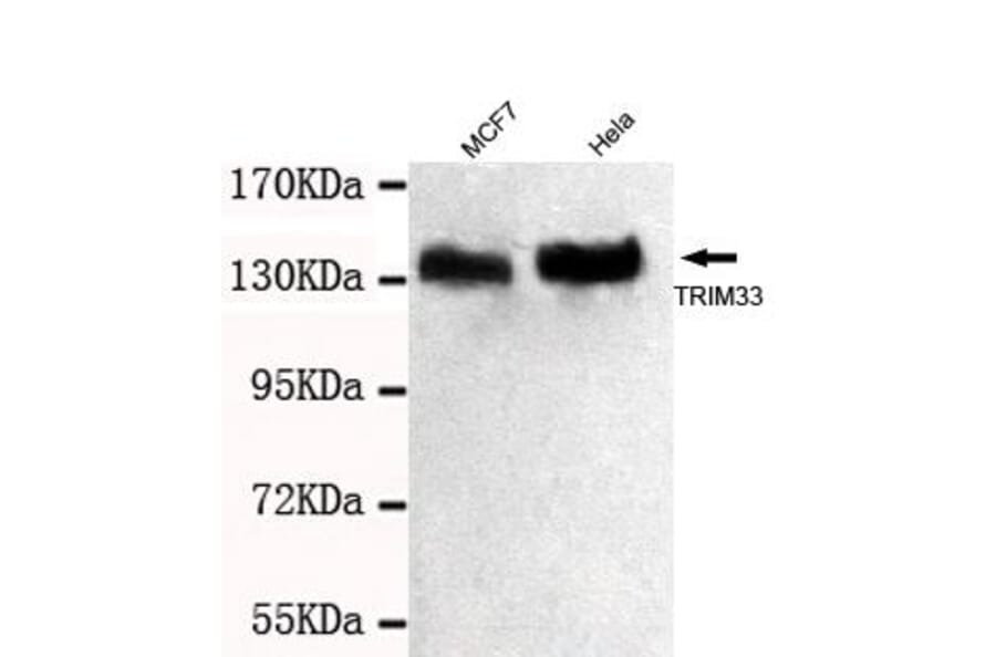 Anti-TRIM33 (C-terminus) Antibody from Bioworld Technology (MB0067) - Antibodies.com