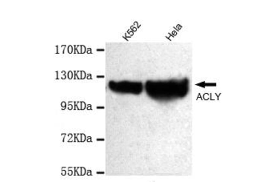 Anti-ATP-Citrate Lyase Antibody from Bioworld Technology (MB0070) - Antibodies.com