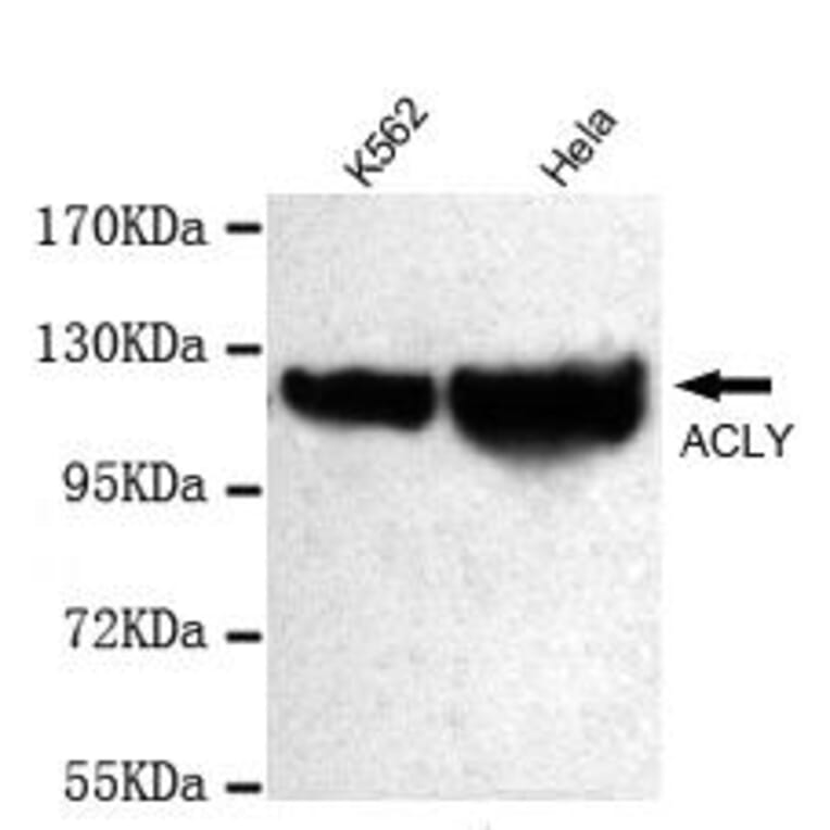 Anti-ATP-Citrate Lyase Antibody from Bioworld Technology (MB0070) - Antibodies.com