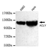 Anti-ATP-Citrate Lyase Antibody from Bioworld Technology (MB0070) - Antibodies.com