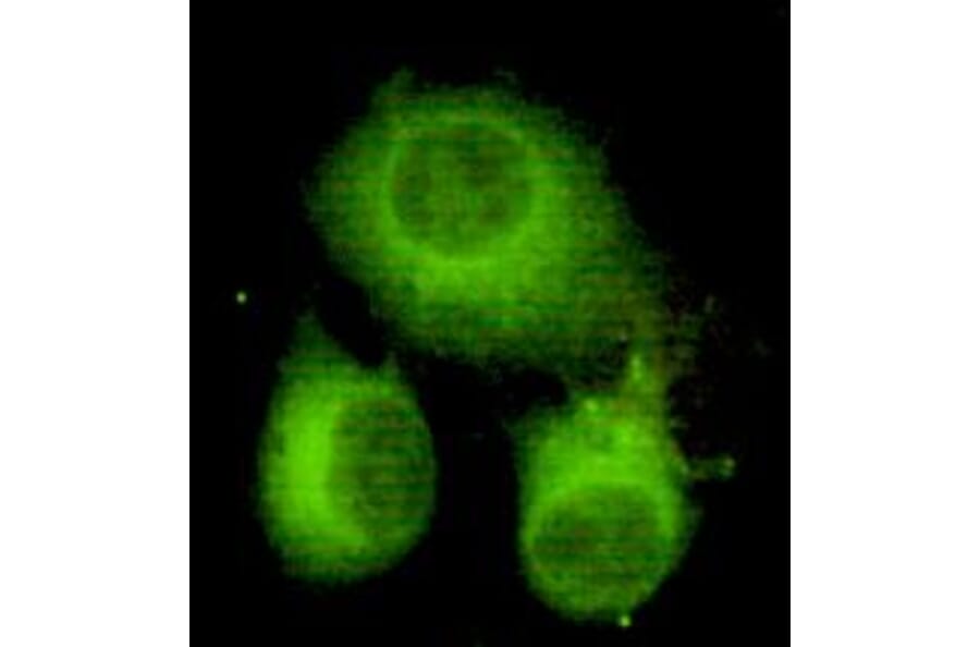 Anti-ATP-Citrate Lyase Antibody from Bioworld Technology (MB0070) - Antibodies.com