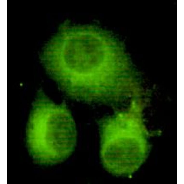 Anti-ATP-Citrate Lyase Antibody from Bioworld Technology (MB0070) - Antibodies.com