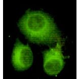 Anti-ATP-Citrate Lyase Antibody from Bioworld Technology (MB0070) - Antibodies.com