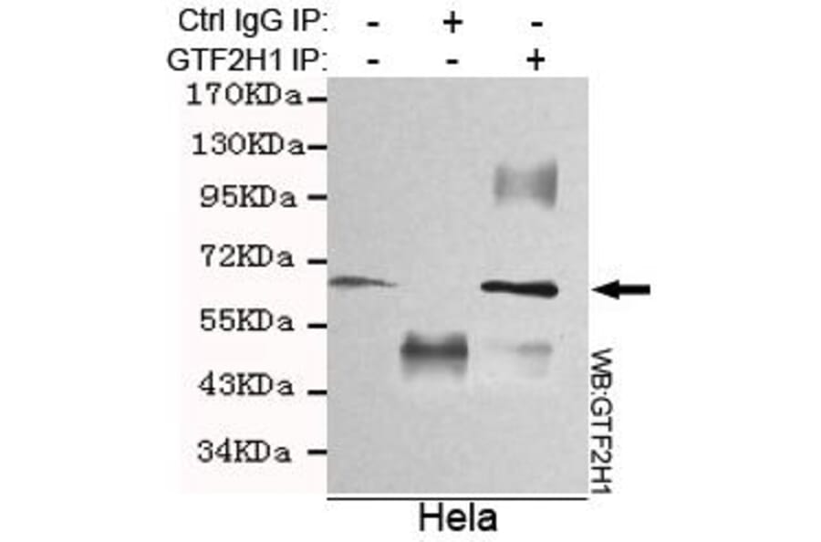 Anti-GTF2H1 Antibody from Bioworld Technology (MB0075) - Antibodies.com