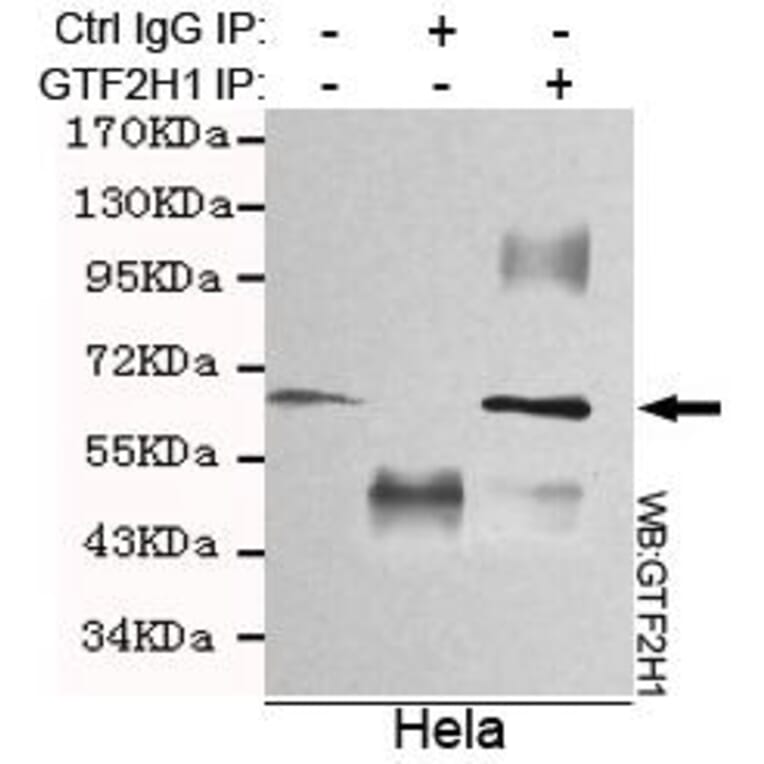 Anti-GTF2H1 Antibody from Bioworld Technology (MB0075) - Antibodies.com