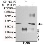 Anti-GTF2H1 Antibody from Bioworld Technology (MB0075) - Antibodies.com