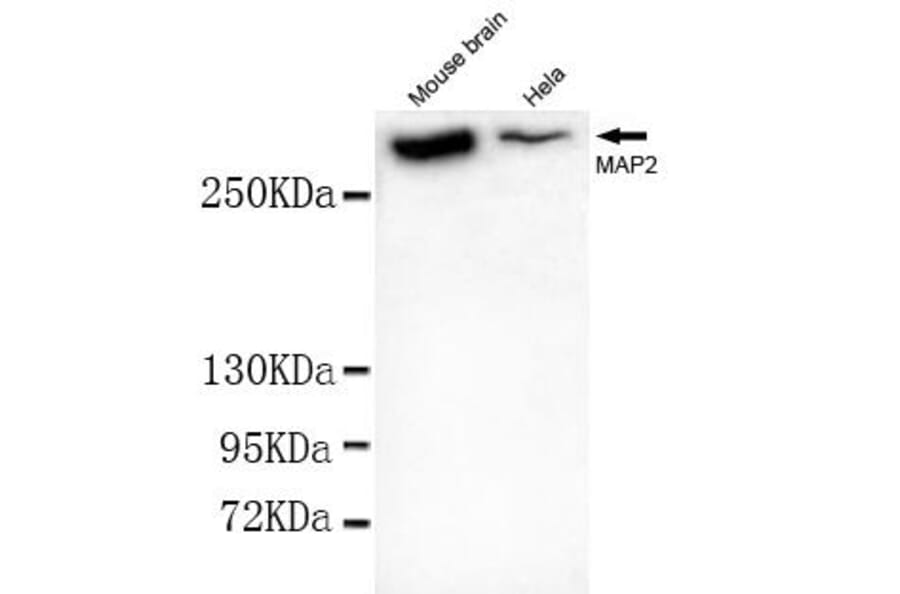 Anti-MAP-2 Antibody from Bioworld Technology (MB0078) - Antibodies.com