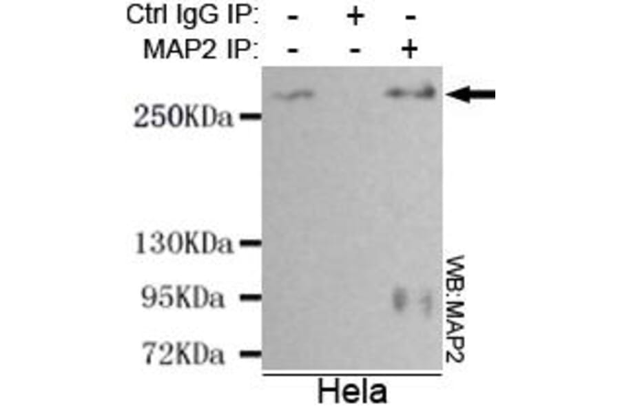 Anti-MAP-2 Antibody from Bioworld Technology (MB0078) - Antibodies.com