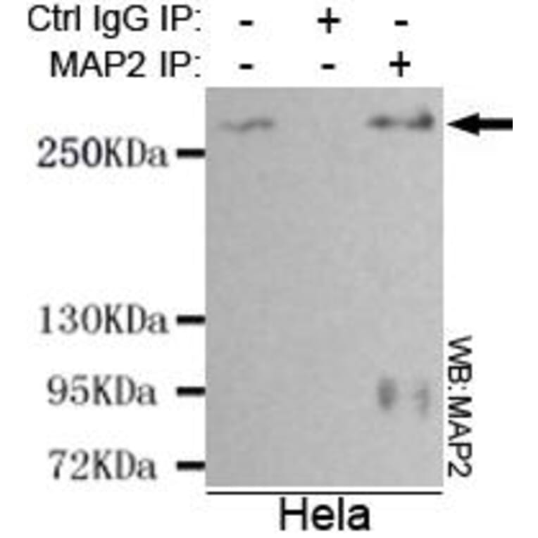 Anti-MAP-2 Antibody from Bioworld Technology (MB0078) - Antibodies.com