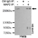 Anti-MAP-2 Antibody from Bioworld Technology (MB0078) - Antibodies.com