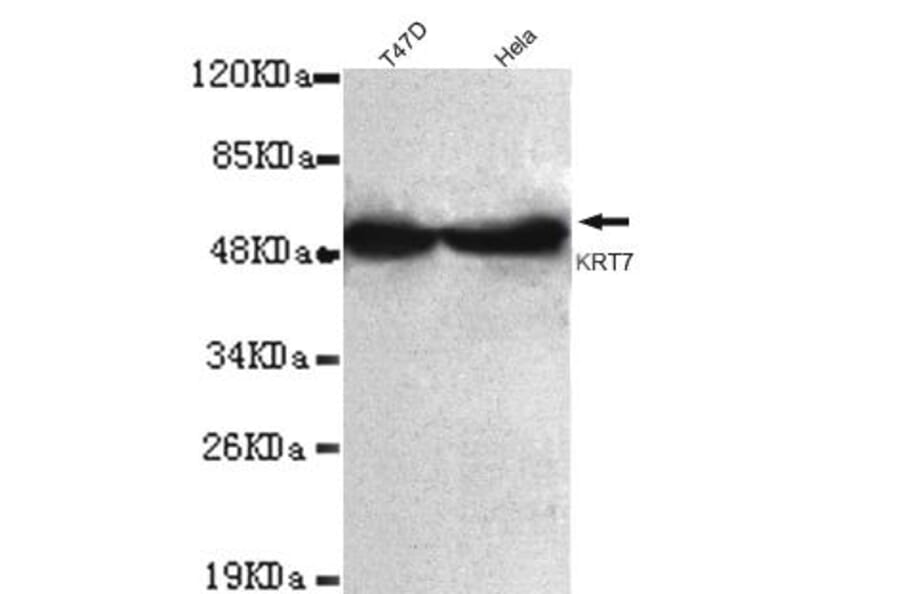Anti-Cytokeratin 7 (C-terminus) Antibody from Bioworld Technology (MB0081) - Antibodies.com