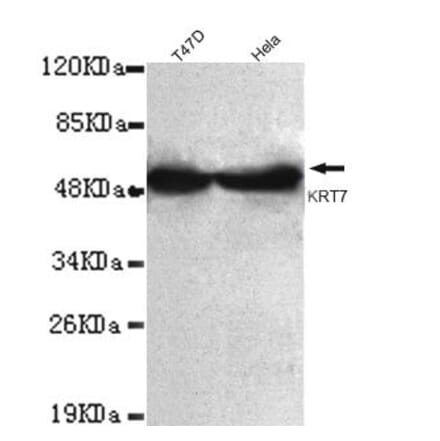 Anti-Cytokeratin 7 (C-terminus) Antibody from Bioworld Technology (MB0081) - Antibodies.com
