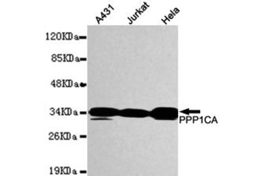 Anti-PP1A / PPP1CA (N-terminus) Antibody from Bioworld Technology (MB0084) - Antibodies.com