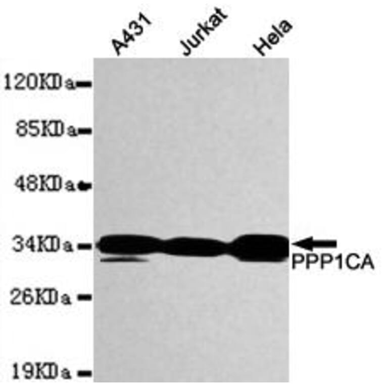 Anti-PP1A / PPP1CA (N-terminus) Antibody from Bioworld Technology (MB0084) - Antibodies.com