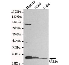 Anti-Rab2A (C-Terminus) Antibody from Bioworld Technology (MB0091) - Antibodies.com