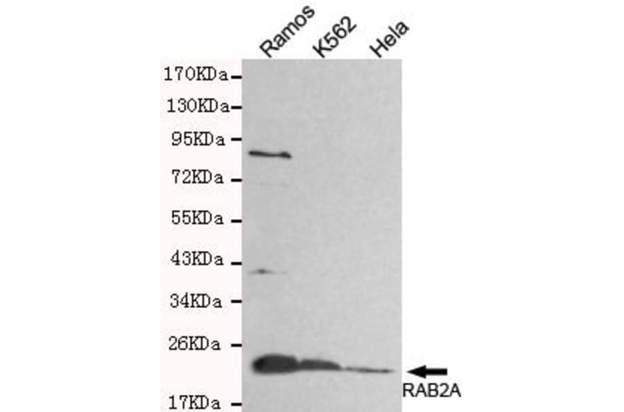 Anti-Rab2A (C-Terminus) Antibody from Bioworld Technology (MB0091) - Antibodies.com