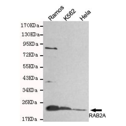 Anti-Rab2A (C-Terminus) Antibody from Bioworld Technology (MB0091) - Antibodies.com