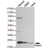 Anti-Rab2A (C-Terminus) Antibody from Bioworld Technology (MB0091) - Antibodies.com