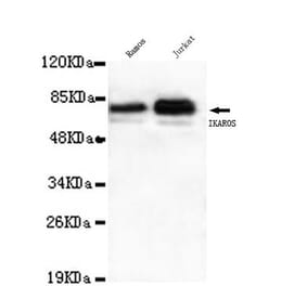 Anti-Ikaros (C-terminus) Antibody from Bioworld Technology (MB0092) - Antibodies.com