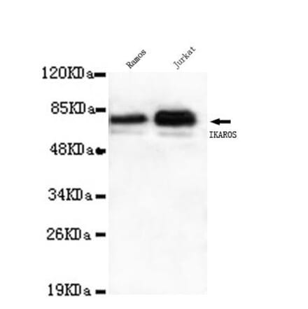 Anti-Ikaros (C-terminus) Antibody from Bioworld Technology (MB0092) - Antibodies.com
