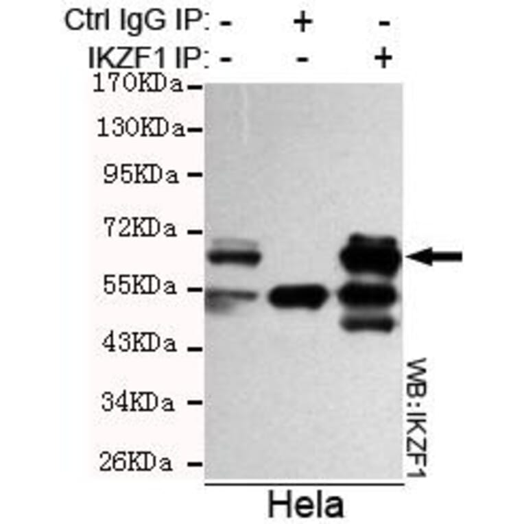 Anti-Ikaros (C-terminus) Antibody from Bioworld Technology (MB0092) - Antibodies.com