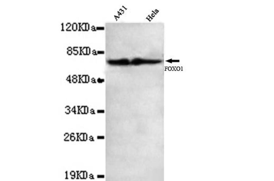 Anti-FKHR / FoxO1 (C-terminus) Antibody from Bioworld Technology (MB0093) - Antibodies.com
