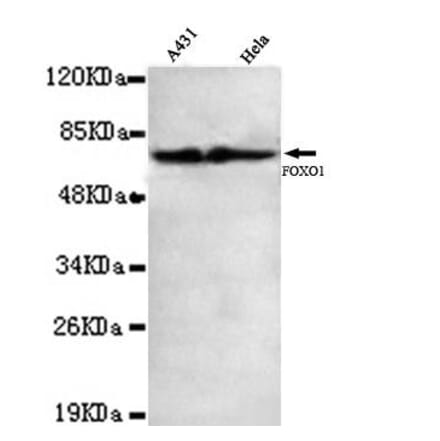 Anti-FKHR / FoxO1 (C-terminus) Antibody from Bioworld Technology (MB0093) - Antibodies.com