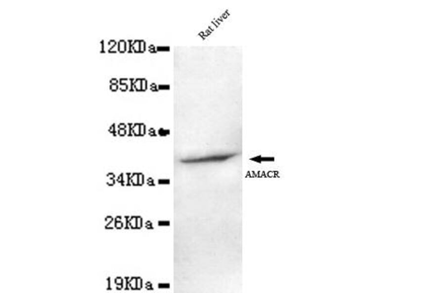 Anti-AMACR (C-terminus) Antibody from Bioworld Technology (MB0099) - Antibodies.com