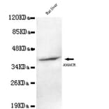 Anti-AMACR (C-terminus) Antibody from Bioworld Technology (MB0099) - Antibodies.com