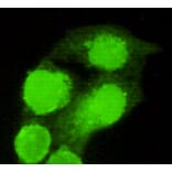 Anti-AMACR (C-terminus) Antibody from Bioworld Technology (MB0099) - Antibodies.com