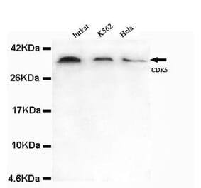 Anti-CDK5 (N-terminus) Antibody from Bioworld Technology (MB0101) - Antibodies.com
