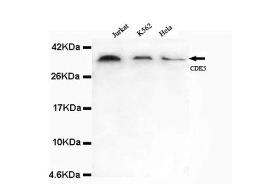 Anti-CDK5 (N-terminus) Antibody from Bioworld Technology (MB0101) - Antibodies.com