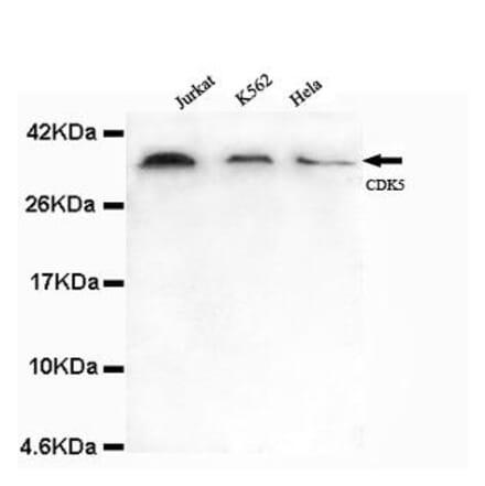 Anti-CDK5 (N-terminus) Antibody from Bioworld Technology (MB0101) - Antibodies.com