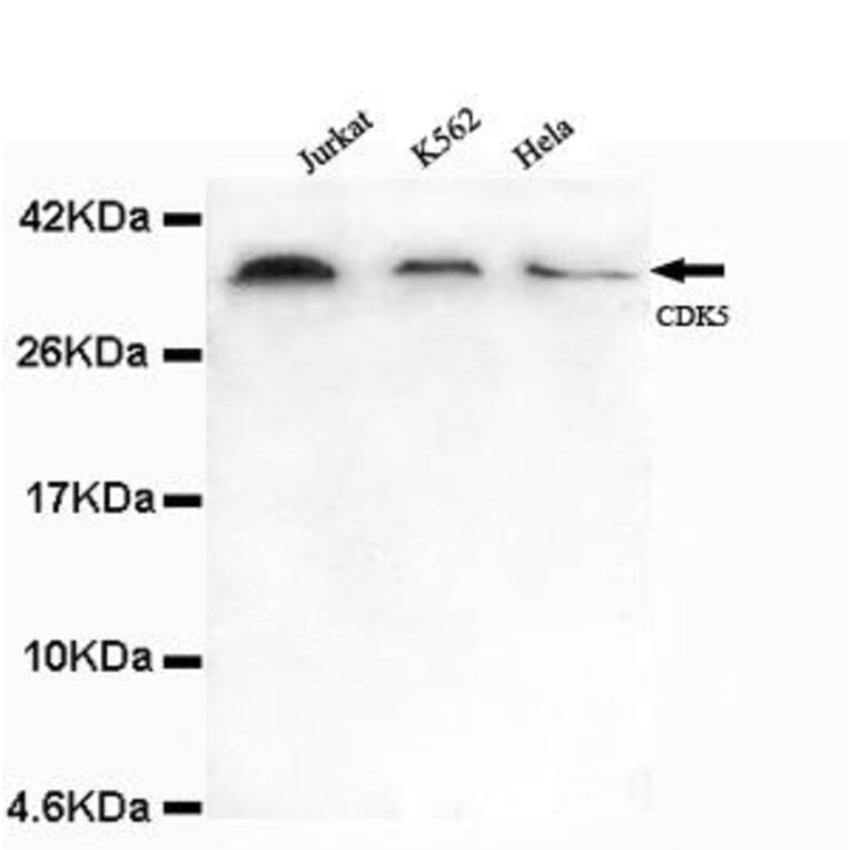 Anti-CDK5 (N-terminus) Antibody from Bioworld Technology (MB0101) - Antibodies.com