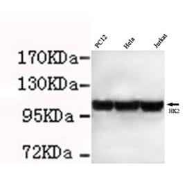Anti-Hexokinase-2 ( N-term) Antibody from Bioworld Technology (MB0103) - Antibodies.com