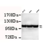 Anti-Hexokinase-2 ( N-term) Antibody from Bioworld Technology (MB0103) - Antibodies.com