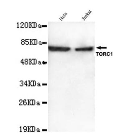 Anti-TORC1 (N-terminus) Antibody from Bioworld Technology (MB0104) - Antibodies.com