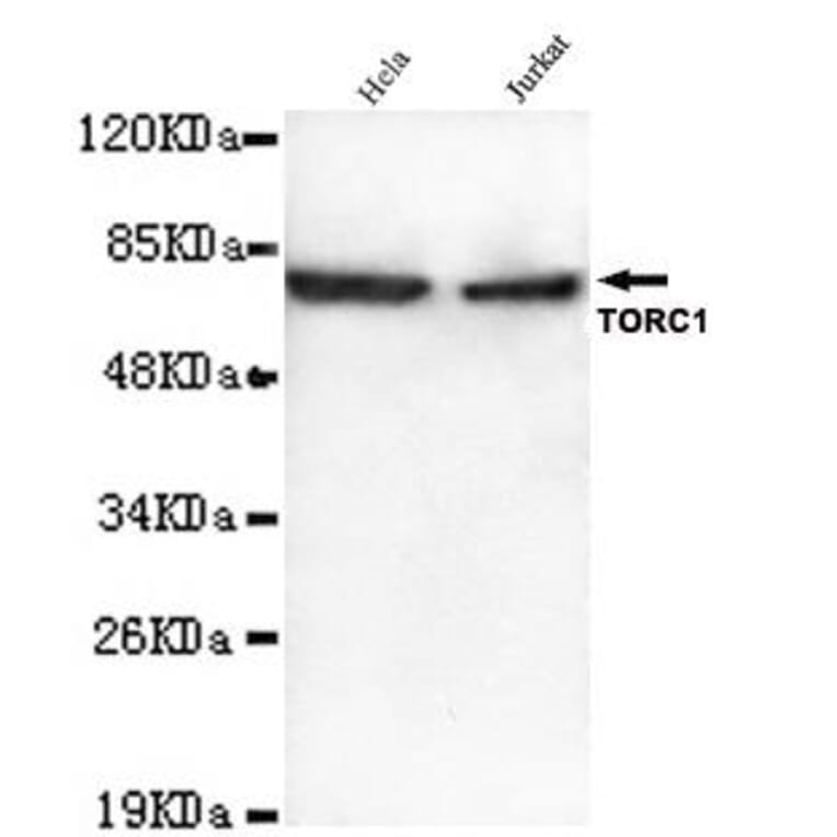 Anti-TORC1 (N-terminus) Antibody from Bioworld Technology (MB0104) - Antibodies.com