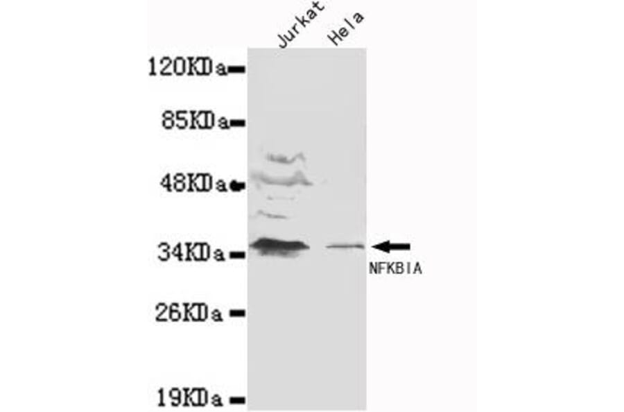 Anti-IkB-α (N-terminus) Antibody from Bioworld Technology (MB0106) - Antibodies.com