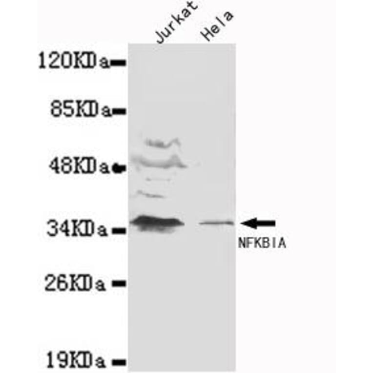 Anti-IkB-α (N-terminus) Antibody from Bioworld Technology (MB0106) - Antibodies.com