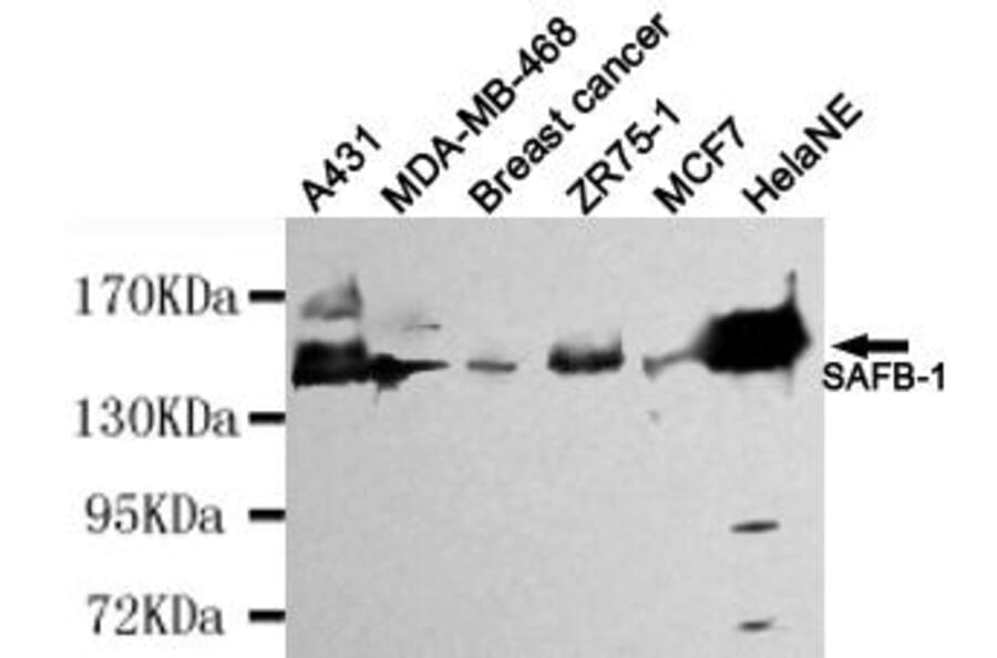 Anti-SAFB-1 Antibody from Bioworld Technology (MB0113) - Antibodies.com