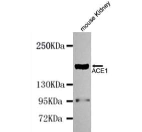Anti-ACE (N-terminus) Antibody from Bioworld Technology (MB0114) - Antibodies.com