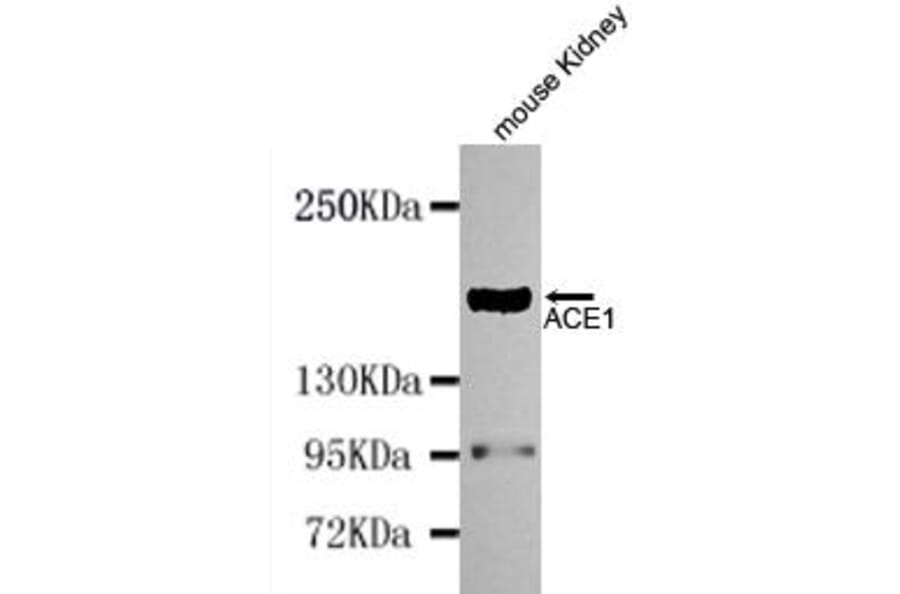 Anti-ACE (N-terminus) Antibody from Bioworld Technology (MB0114) - Antibodies.com