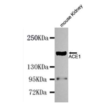 Anti-ACE (N-terminus) Antibody from Bioworld Technology (MB0114) - Antibodies.com