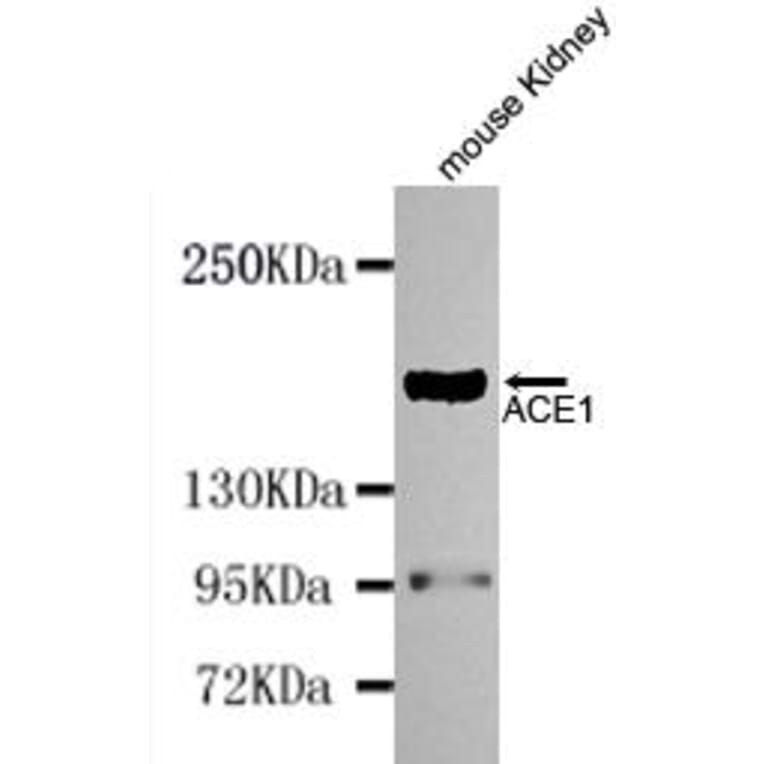 Anti-ACE (N-terminus) Antibody from Bioworld Technology (MB0114) - Antibodies.com