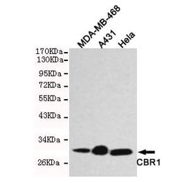 Anti-CBR1 Antibody from Bioworld Technology (MB0121) - Antibodies.com