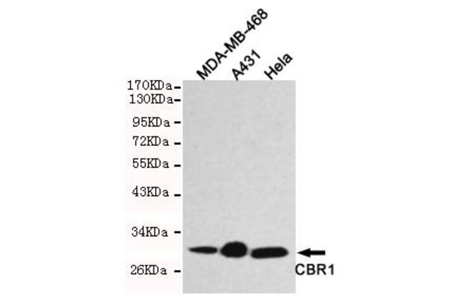 Anti-CBR1 Antibody from Bioworld Technology (MB0121) - Antibodies.com