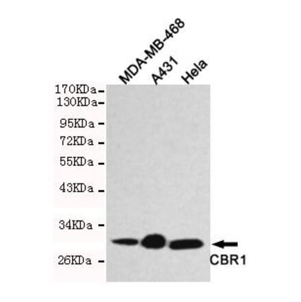 Anti-CBR1 Antibody from Bioworld Technology (MB0121) - Antibodies.com