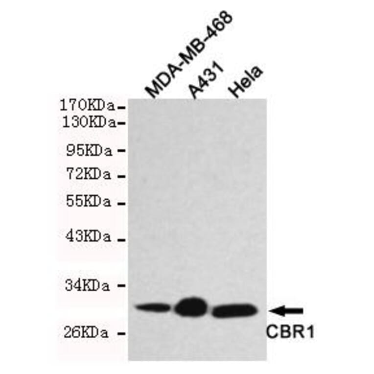 Anti-CBR1 Antibody from Bioworld Technology (MB0121) - Antibodies.com